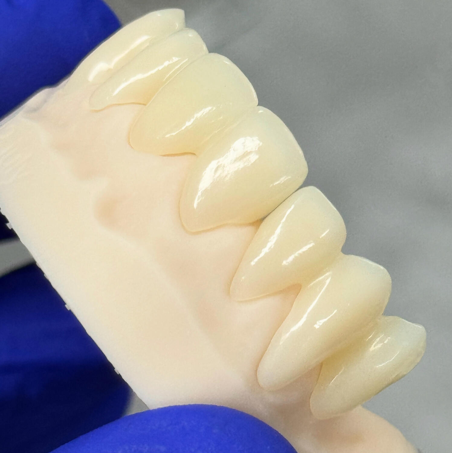 Coroane provizorii multilayer